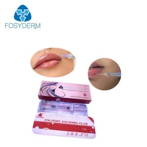 1ml Lip Dermal Filler Injections Cross Linked Hyaluronic Acid