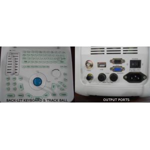 4d Ultrasound Machine Portable Ultrasound Scanner With 120G Capacity 4800 Frames
