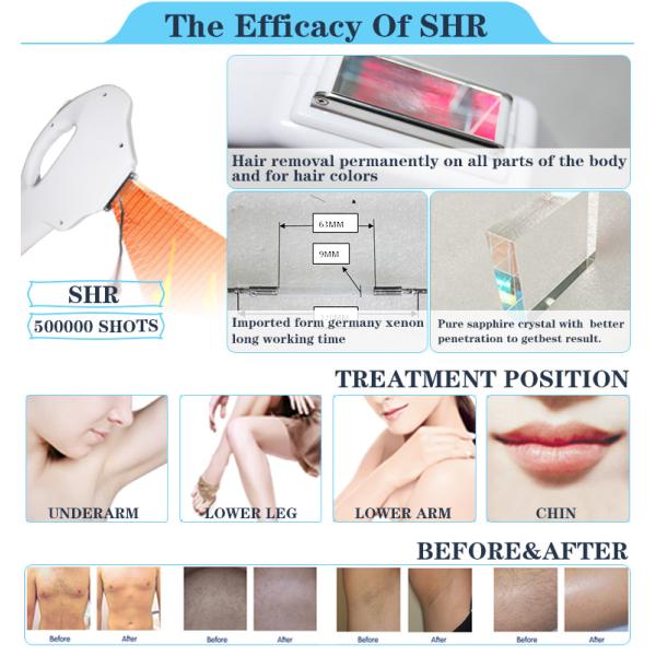 OEM ODM fda approved beauty products opt ipl shr laser hair removal machine for clinic