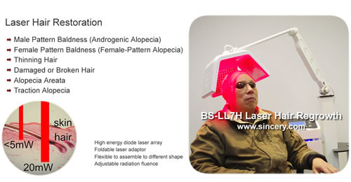 Max 20Mw Per Diode Laser Hair Regrowth Device Laser Treatment For Baldness