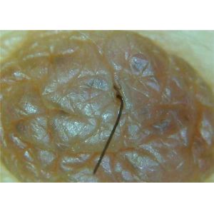 USB2.0 Portable Digital Video Dermatoscope Skin And Hair Detector With 8 LED