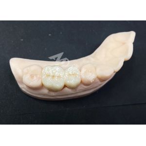 High Translucency Zirconia Crown Natural Looking Design with Chipping Resistance