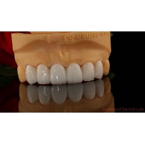 Wholesale Full Contour Zirconia Crown Translucency 3D PRO No Porcelian Overlay Standard Dental Lab from china suppliers