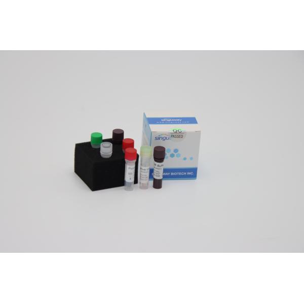 Quality Laboratory Multiplex Fast Real Time RT PCR Detection Kit Reagents For Sars Virus Detection for sale