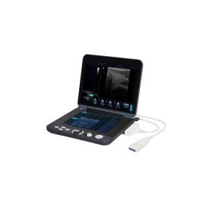 Digital Portable Mobile Laptop Ultrasound Scanner With 12-inch LED Display & 9.7