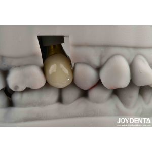 Various Sizes Implant Crown And Bridge For Strong Dental Implants Compatibility
