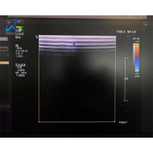 L12-3 Linear Array Transducer Probe Ultrasound Crystal And Cable Replacement