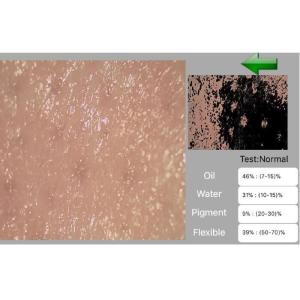 Digital Microscope for Skin and Scalp Video Dermatoscope with 2 Million Pixels