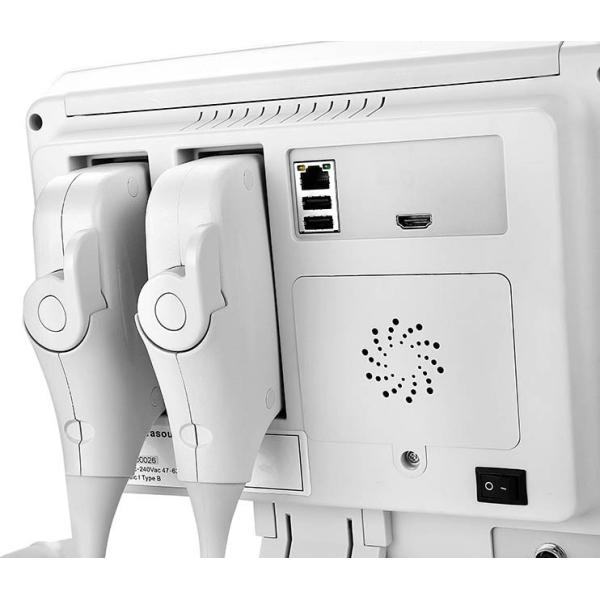 Notebook Type Color Doppler Ultrasound Scanner Usg For Human / Veterinary