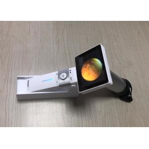 2560 X 1920 Pixels Digital Fundus Camera