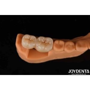 V Shaped Thread Type Finished Abutments Compatibility With All Major Implant