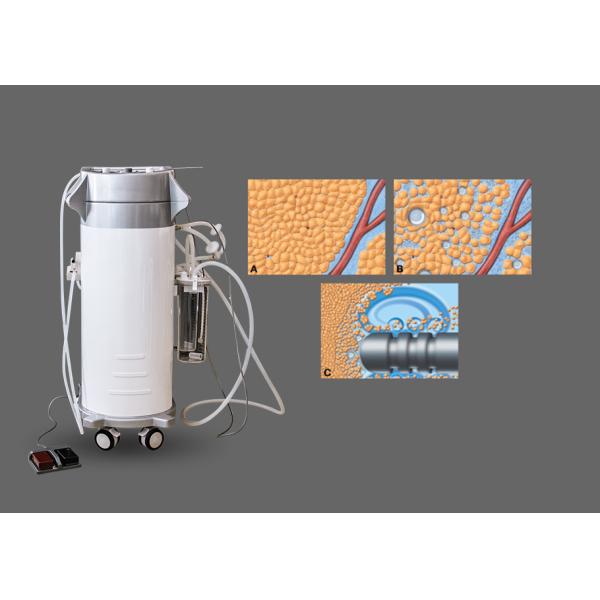 PAL Vibro Lipo Surgical Liposuction Machine 300W High Efficiency For Slimming