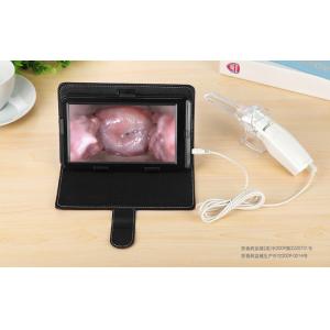 Vaginal Camera Cervix Camera Digital Electronic Video Colposcope for Gyneclogy