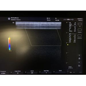 GE VividE Original Linear Ultrasound Probe 9L-RS , GE Ultrasound Transducers 3.3