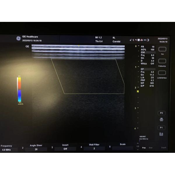 GE VividE Original Linear Ultrasound Probe 9L-RS , GE Ultrasound Transducers 3.3