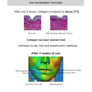 High Quality Portable Micro Needling Rf Machine Painless And Supple Morpheus 8