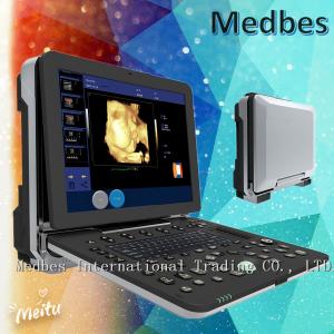 China 4D Portable Echocardiography Machine 4D Echo Color Digital Portable Ultrasound Machine on sale
