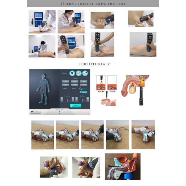 ED Therapy Electromagnetic Pneumatic Shockwave Therapy Machine