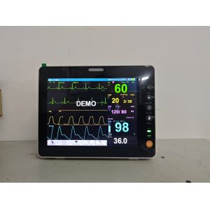 Portable Multi Parameter Patient Monitor for vet