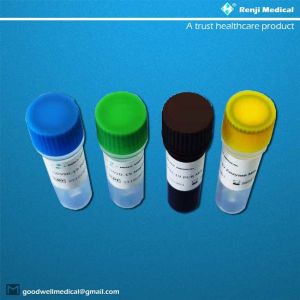 RNA 2019-NCoV Detection Kit 95% Sensitivity 60 Min Workflow