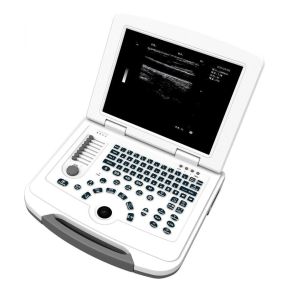 250mm Depth LED Display Medical Ultrasound Scanner