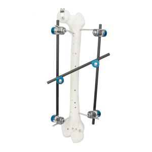Hoffmann Ii Orthopedic External Fixator Straight Rod For Tibia Femur Fractures