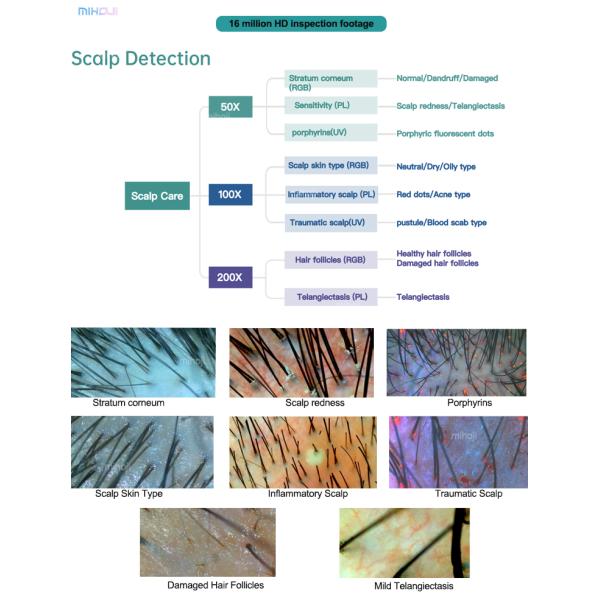 Customizable Scalp Analysis Machine For Dryness And Dandruff Problem