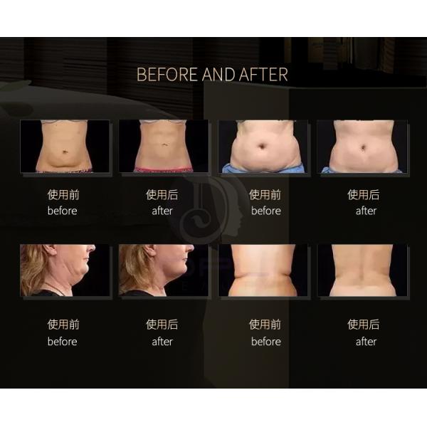 AS86 Portable 80K Cavitation Rf Vacuum Slimming Machine Body Shaping