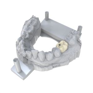 Flexible Permanent Crown Resin Strong Adhesion and Compatibility with Ceramic