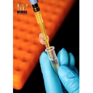 NT-proBNP Rapid Quantitative Test Kit POCT WWHS IFA IVD Blood Diagnostic
