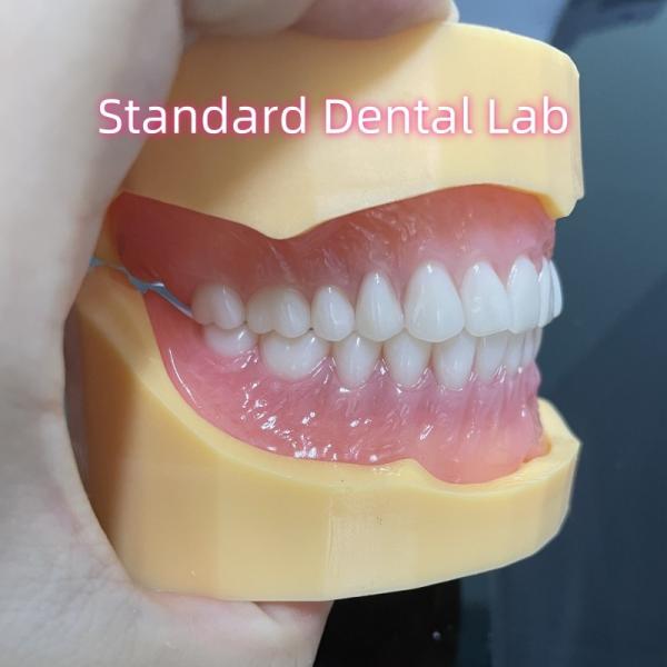 Durable Dental Prosthesis Full Arch Acrylic Teeth Partial Removable Dentures