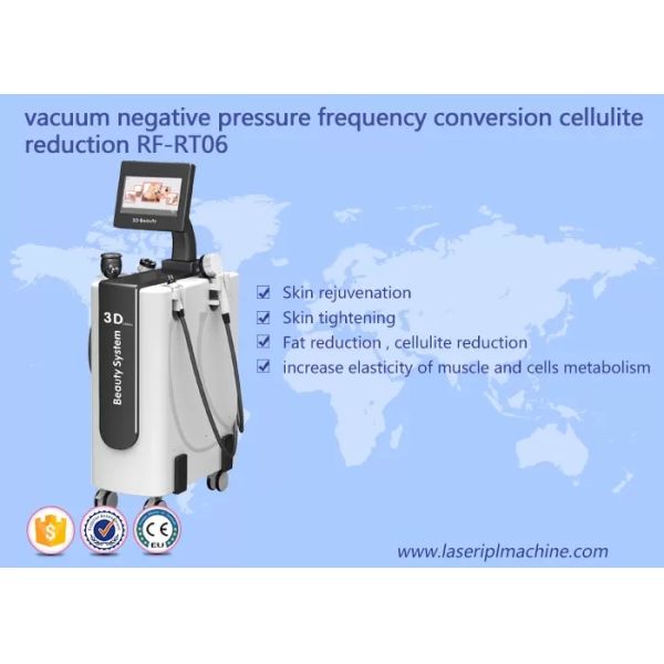 Face Lifting Wrinkle Removal 110v 220v RF Beauty Equipment