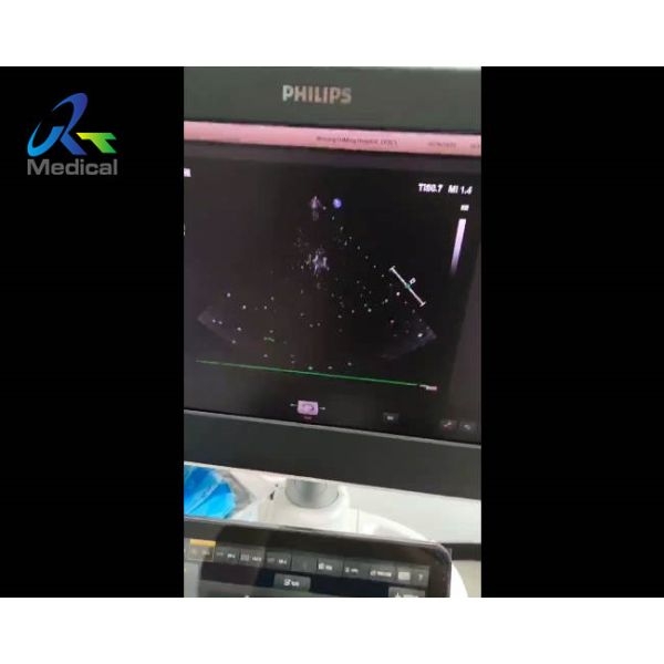 EPIQ 5 Ultrasound Machine Repair Abnormal Image Snowflake Interference Replace