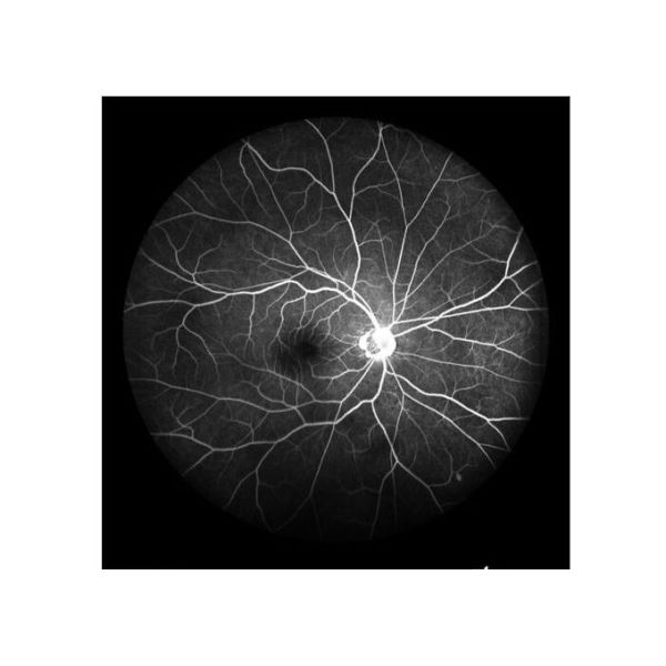 Ultra-wide Field Laser Scanning Retina Angiograph Digital Ophthalmic Equipment With Optical Zoom 100°/60°/30°