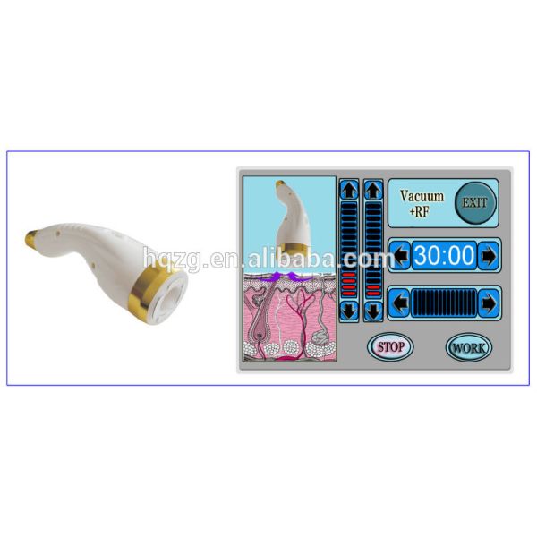 Weight Loss RF Cavitation Slimming Machine