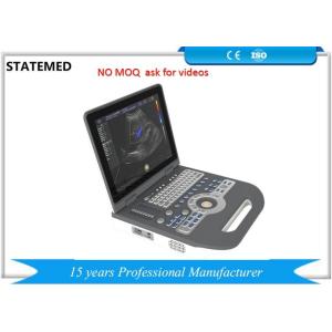 4d Image Technology Color Doppler Ultrasound Scanner For Pregnancy Ultrasound