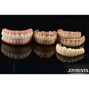 Zirconia for Restoring Chewing Function Optimal Functionality Guaranteed