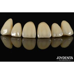 Bionic Development Leaves And Distinct Layers Of Zirconia All-Ceramic