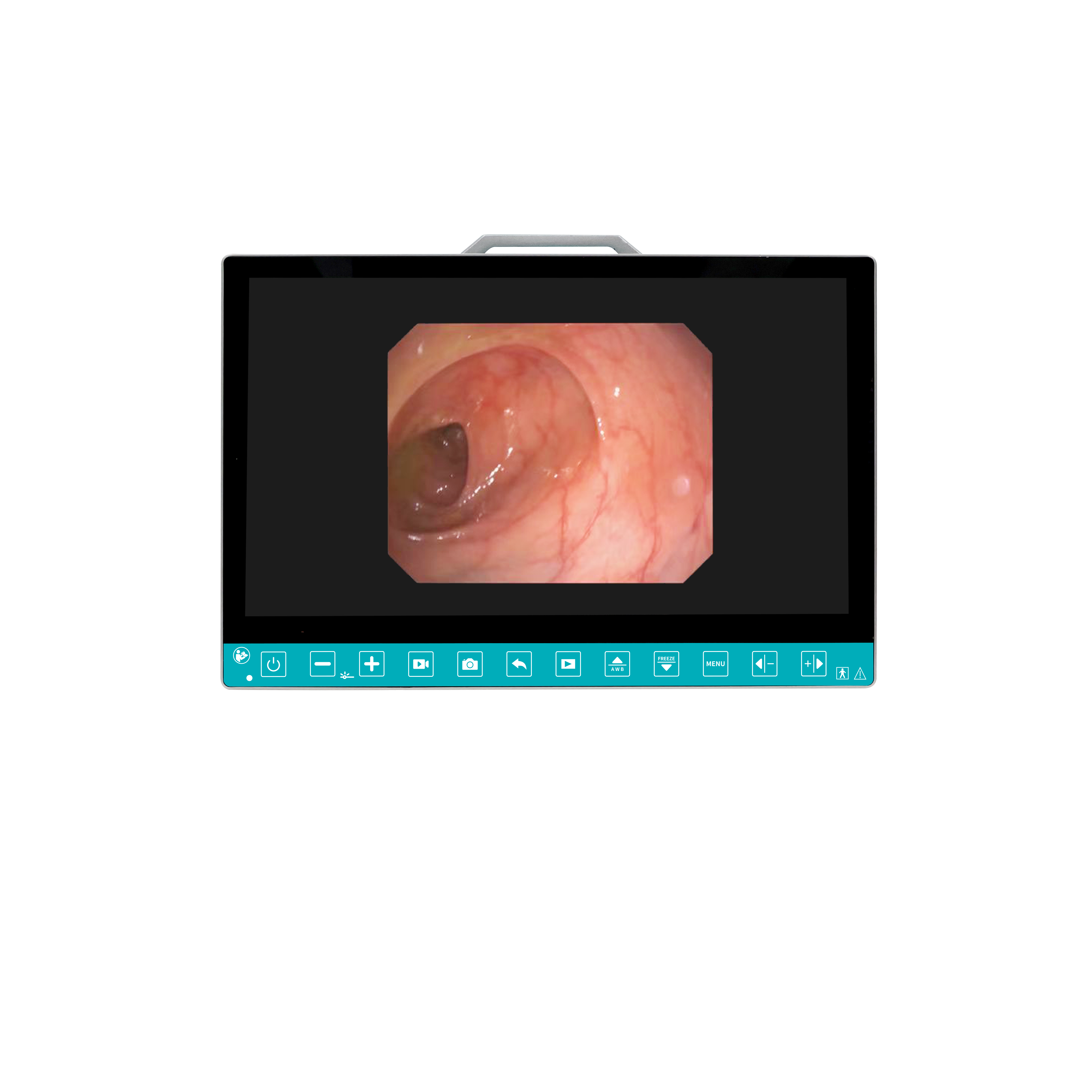 13.3-Inch 1080p HDMI Flexible Endoscope Camera System for Urology ENT Surgery