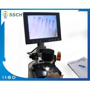 7 Inch Black LCD Capillary Nail Microcirculation LED Cold Light
