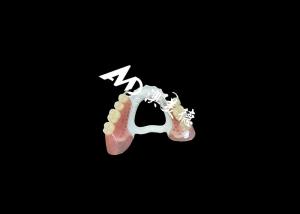China High-Quality Removable Denture with Durable HPP Framework and Comfortable Acrylic Base for a Secure Fit and Long-Lasting Performance on sale