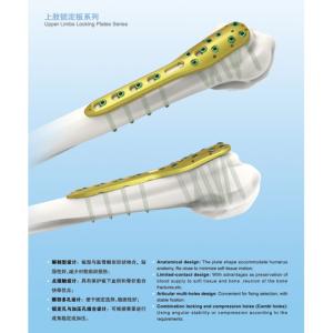 Distal Radius Distal Fibula Locking Plate And Screw L/R Type