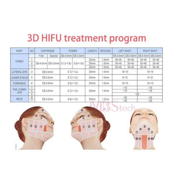 3d 11 Lines Anti Wrinkle Ultrasound Facelift HIFU Facial Machine