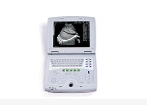 Mobile Ultrasound Machine Digital Laptop Ultrasound Scanner with 100 Frames