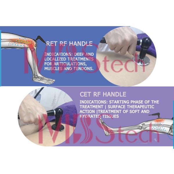 Medical Tecar Therapy Machine