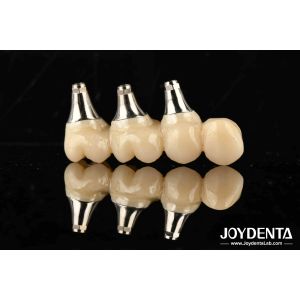 Ultra-precision processing Zirconia Implants All-Zirconium Integrated Crown