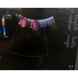 GE 4C Convex Ultrasound Probe Repair Transducer Miantenance