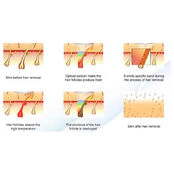 360W Painless Permanent Hair Remover