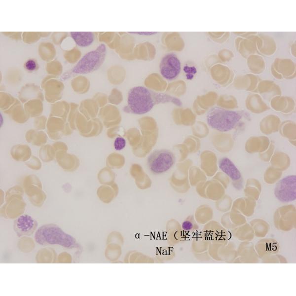 a-Naphthyl Acetate Esterase Stain (a-NAE) (Fast blue method) 20 Tests for Healthcare Facility