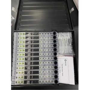 Neurofilament Protein (N-F) —AD7c-NTP in Fully Automated Immunoassay Analyzer